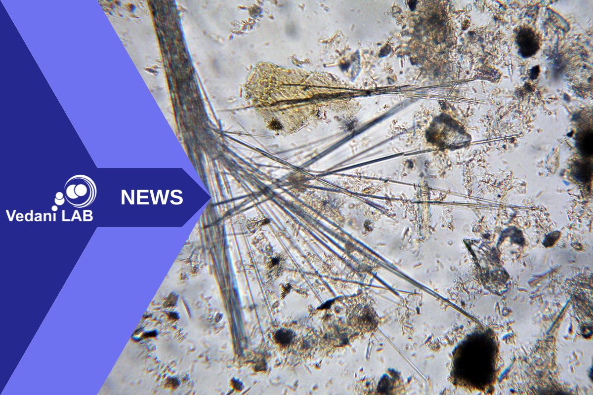 Analisi delle fibre aerodisperse con SEM: precisione dello 0,1% per una valutazione affidabile